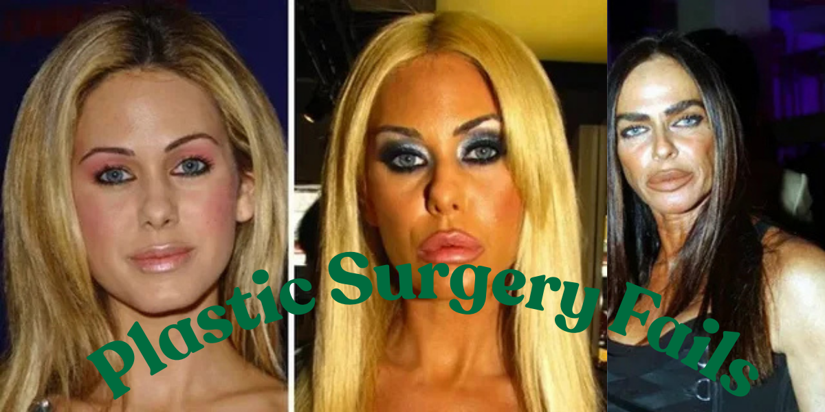 Plastic Surgery Fails