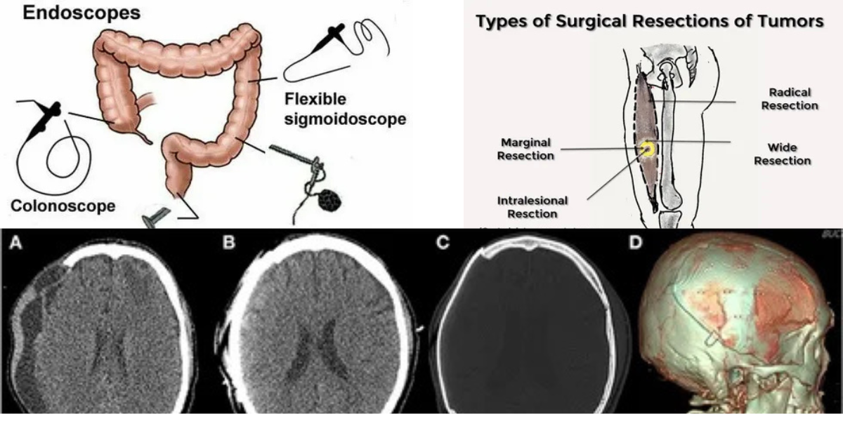 Plastic Surgery Fails: What Happens When Expectations Collapse