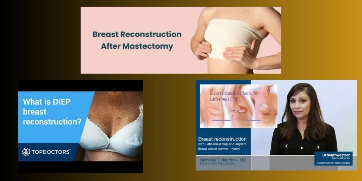 Poland Syndrome: Causes, Symptoms, Diagnosis, and Modern Treatment Options