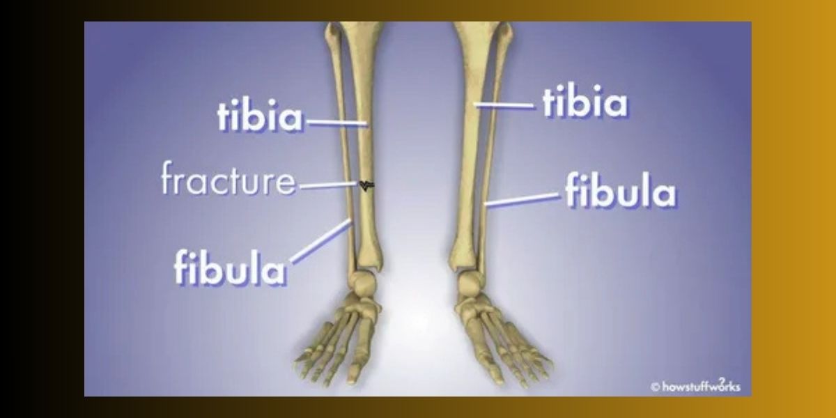 Tibia Bone: Complete Anatomy, Function, and Recovery Guide